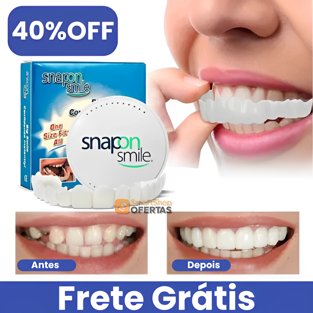 Snapon Smile™ - Facetas Odontológicas Removíveis [Sorriso Perfeito]